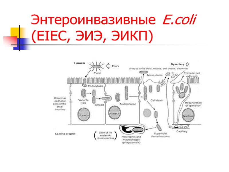Энтероинвазивные E.coli (EIEC, ЭИЭ, ЭИКП)